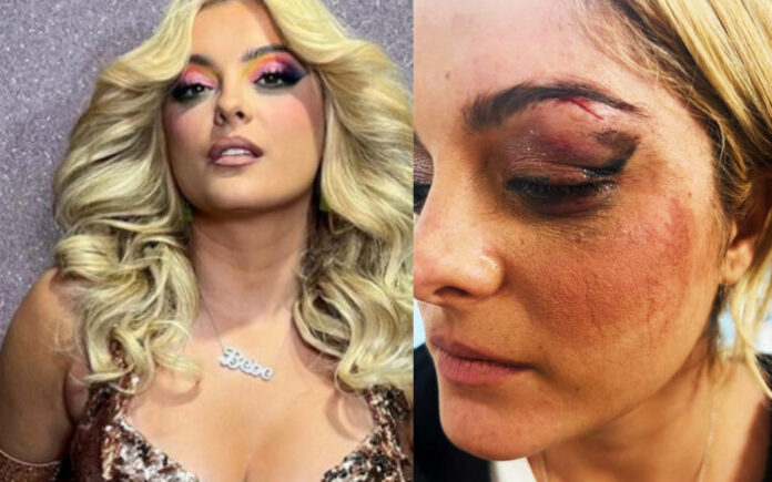 Bebe Rexha fue atacada en pleno concierto Yucatán Al Momento