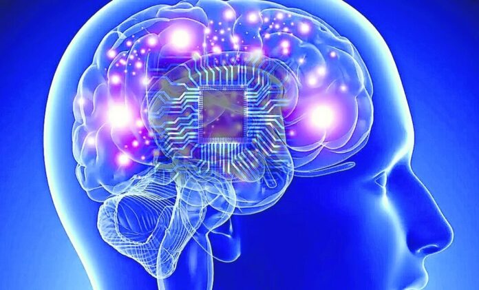 implantes-cerebrales-una-revolucion-en-la-medicina-yucatan-al-momento